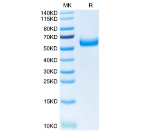 Tris-Bis PAGE - Recombinant Human TREM2 Protein (C-terminal Human Fc Tag) (A331375) - Antibodies.com