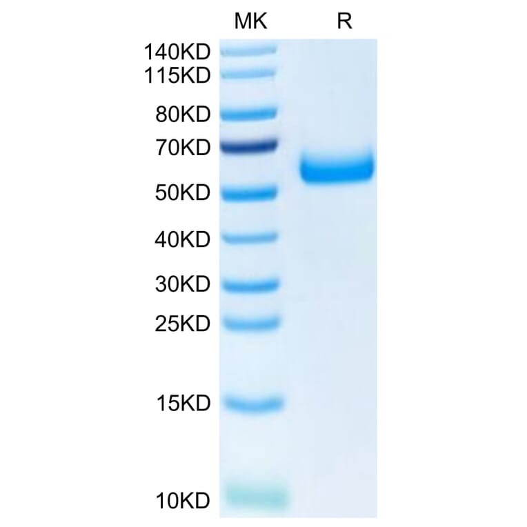 Tris-Bis PAGE - Recombinant Human TREM2 Protein (C-terminal Human Fc Tag) (A331375) - Antibodies.com