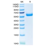 Tris-Bis PAGE - Recombinant Human TREM2 Protein (C-terminal Human Fc Tag) (A331375) - Antibodies.com
