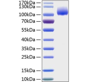 SDS-PAGE - Recombinant Human TrkA Protein (C-terminal Human Fc and His Tag) (A331376) - Antibodies.com