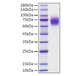 SDS-PAGE - Recombinant human TrkA Protein (C-terminal His Tag) (A331377) - Antibodies.com