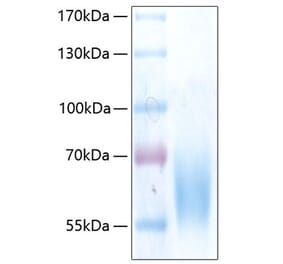 SDS-PAGE - Recombinant Human TrkB Protein (C-terminal His Tag) (A331378) - Antibodies.com