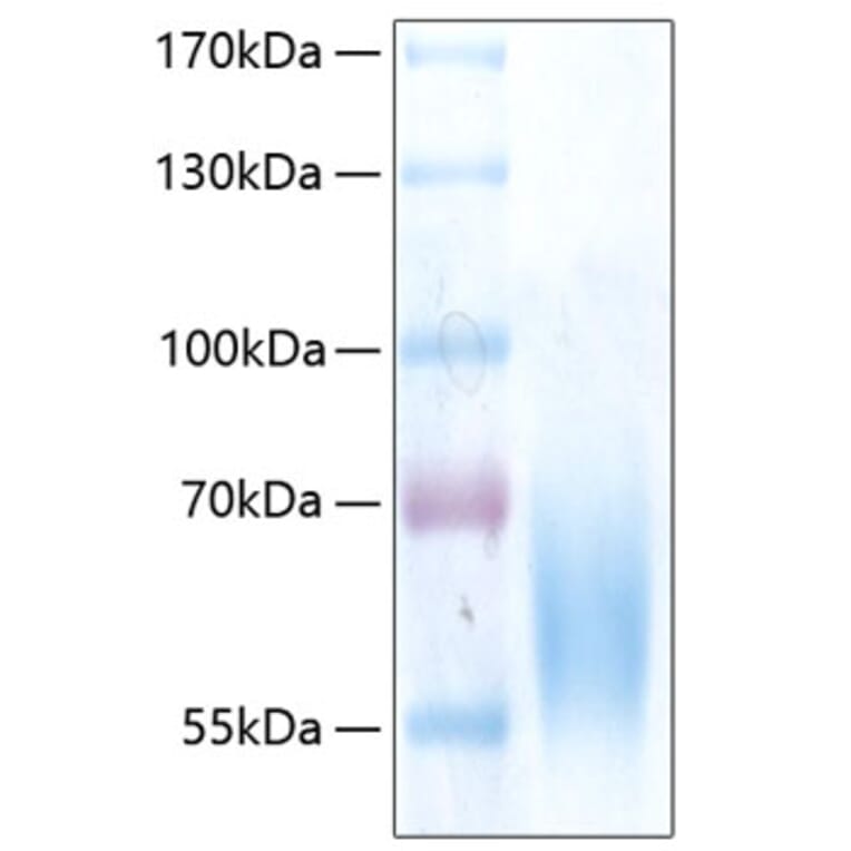 SDS-PAGE - Recombinant Human TrkB Protein (C-terminal His Tag) (A331378) - Antibodies.com