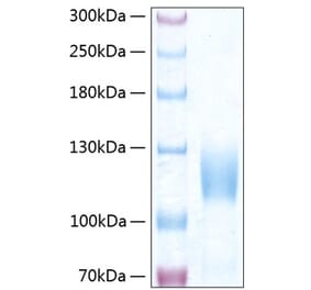 SDS-PAGE - Recombinant Human TrkC Protein (C-terminal Human Fc and His Tag) (A331379) - Antibodies.com