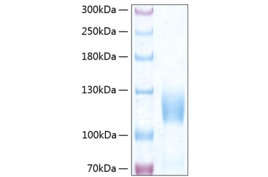 SDS-PAGE - Recombinant Human TrkC Protein (C-terminal Human Fc and His Tag) (A331379) - Antibodies.com
