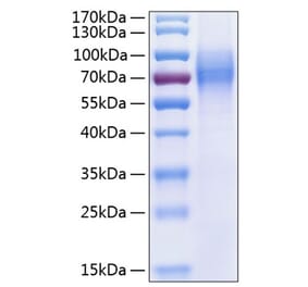 SDS-PAGE - Recombinant Human TrkC Protein (C-terminal His Tag) (A331380) - Antibodies.com