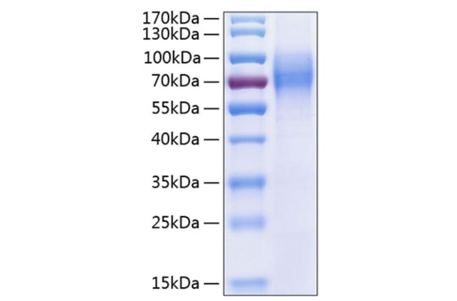 SDS-PAGE - Recombinant Human TrkC Protein (C-terminal His Tag) (A331380) - Antibodies.com