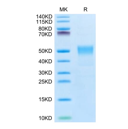 Tris-Bis PAGE - Recombinant Human TROP2 Protein (Biotin) (C-terminal His and Avi Tag) (A331381) - Antibodies.com