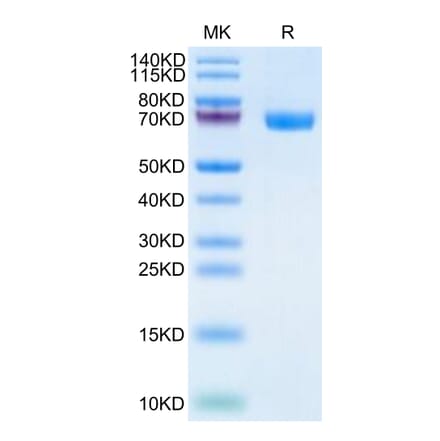 Tris-Bis PAGE - Recombinant Human TROP2 Protein (C-terminal Human Fc Tag) (A331383) - Antibodies.com