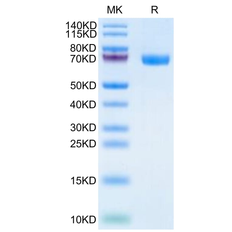Tris-Bis PAGE - Recombinant Human TROP2 Protein (C-terminal Human Fc Tag) (A331383) - Antibodies.com