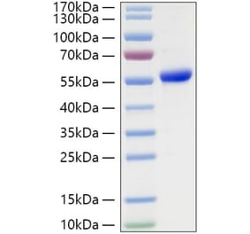 SDS-PAGE - Recombinant Human TSHR Protein (C-terminal His Tag) (A331384) - Antibodies.com
