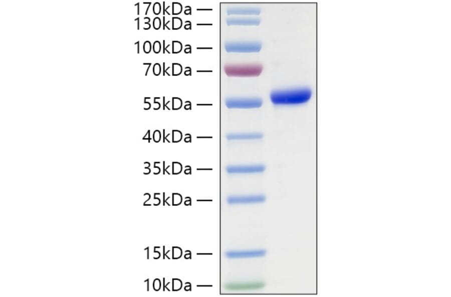 SDS-PAGE - Recombinant Human TSHR Protein (C-terminal His Tag) (A331384) - Antibodies.com