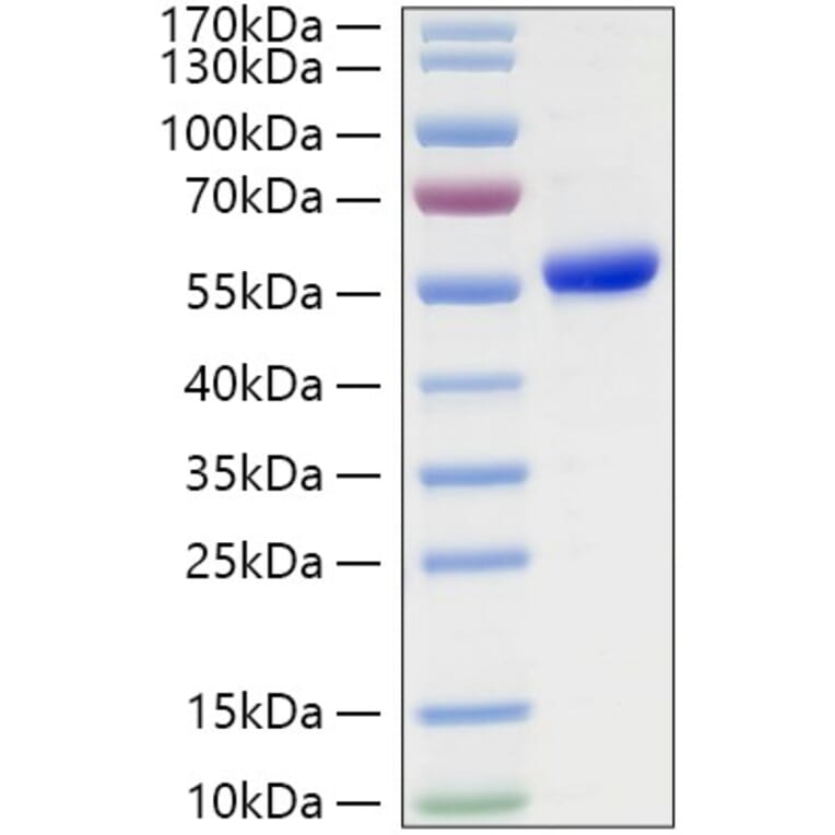 SDS-PAGE - Recombinant Human TSHR Protein (C-terminal His Tag) (A331384) - Antibodies.com