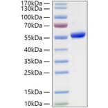 SDS-PAGE - Recombinant Human TSHR Protein (C-terminal His Tag) (A331384) - Antibodies.com