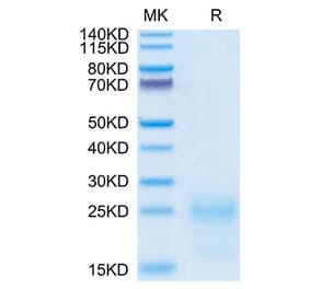 Tris-Bis PAGE - Recombinant Cynomolgus macaque TSLP Protein (C-terminal His Tag) (A331385) - Antibodies.com