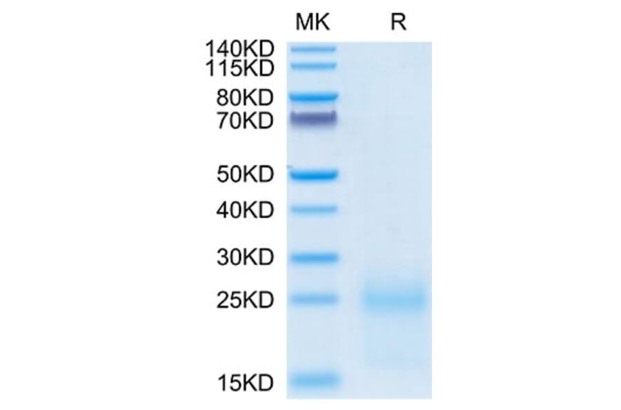 Tris-Bis PAGE - Recombinant Cynomolgus macaque TSLP Protein (C-terminal His Tag) (A331385) - Antibodies.com