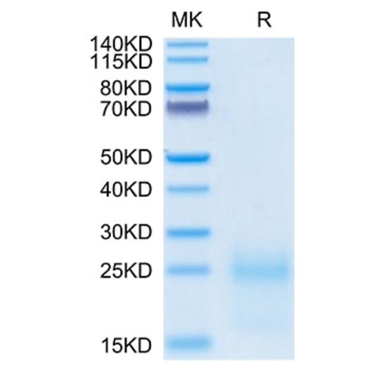 Tris-Bis PAGE - Recombinant Cynomolgus macaque TSLP Protein (C-terminal His Tag) (A331385) - Antibodies.com