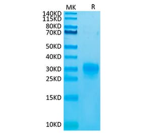 Tris-Bis PAGE - Recombinant Human TSLP Protein (Biotin) (C-terminal His and Avi Tag) (A331386) - Antibodies.com