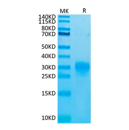 Tris-Bis PAGE - Recombinant Human TSLP Protein (Biotin) (C-terminal His and Avi Tag) (A331386) - Antibodies.com