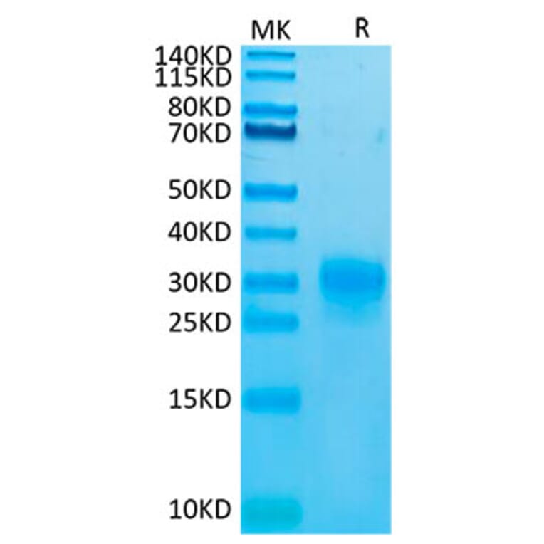 Tris-Bis PAGE - Recombinant Human TSLP Protein (Biotin) (C-terminal His and Avi Tag) (A331386) - Antibodies.com
