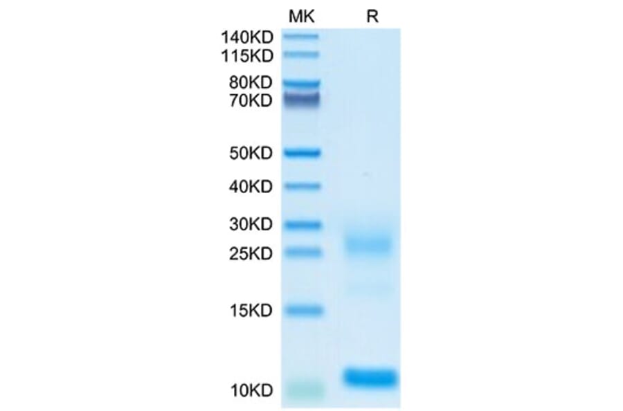 Tris-Bis PAGE - Recombinant Human TSLP Protein (Biotin) (C-terminal His and Avi Tag) (A331387) - Antibodies.com
