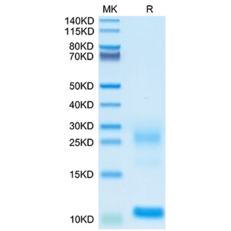 Tris-Bis PAGE - Recombinant Human TSLP Protein (Biotin) (C-terminal His and Avi Tag) (A331387) - Antibodies.com