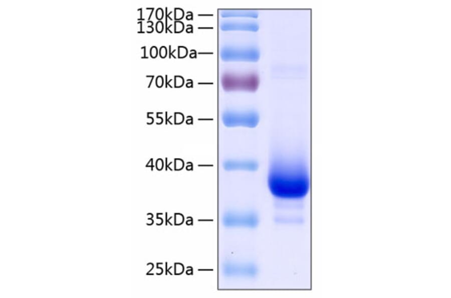 SDS-PAGE - Recombinant Human TWEAKR/FN14 Protein (C-terminal Human Fc and His Tag) (A331389) - Antibodies.com