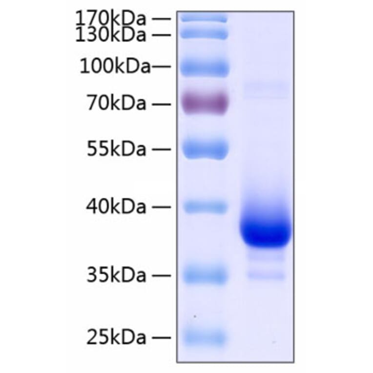 SDS-PAGE - Recombinant Human TWEAKR/FN14 Protein (C-terminal Human Fc and His Tag) (A331389) - Antibodies.com