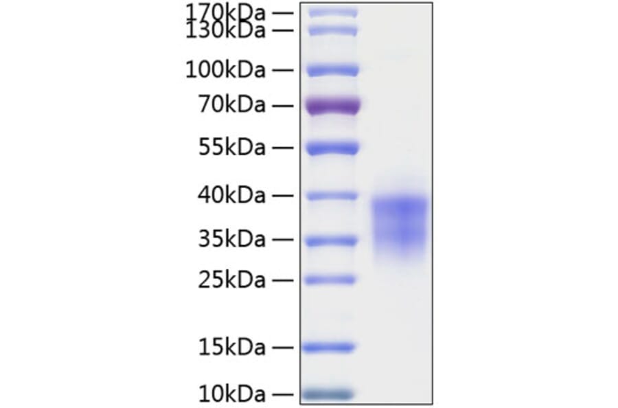 SDS-PAGE - Recombinant Human TWSG1 Protein (C-terminal His Tag) (A331390) - Antibodies.com