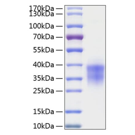 SDS-PAGE - Recombinant Human TWSG1 Protein (C-terminal His Tag) (A331390) - Antibodies.com