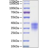 SDS-PAGE - Recombinant Human TWSG1 Protein (C-terminal His Tag) (A331390) - Antibodies.com