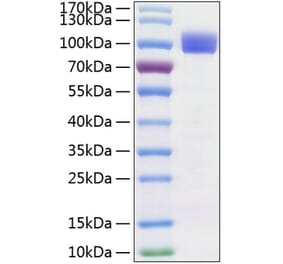 SDS-PAGE - Recombinant Human TYRO3 Protein (C-terminal Human Fc and His Tag) (A331391) - Antibodies.com