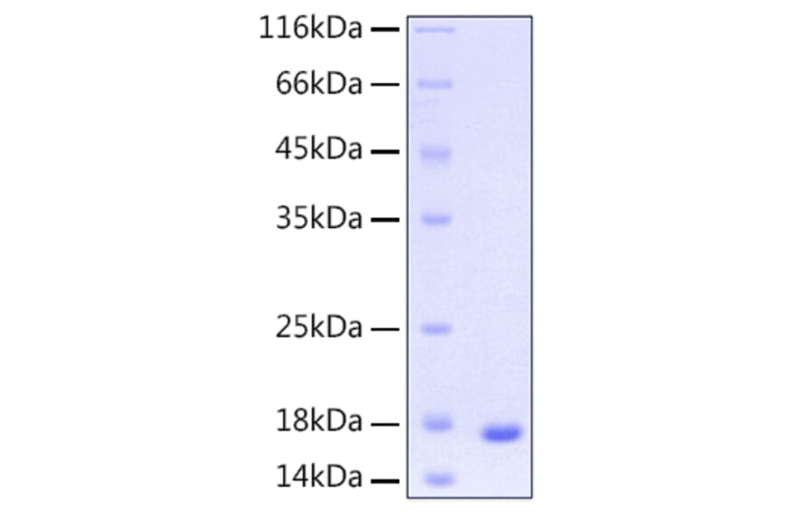SDS-PAGE - Recombinant Human UBE2D3 Protein (C-terminal His Tag) (A331392) - Antibodies.com