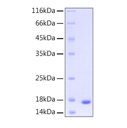 SDS-PAGE - Recombinant Human UBE2D3 Protein (C-terminal His Tag) (A331392) - Antibodies.com