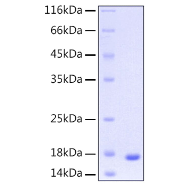 SDS-PAGE - Recombinant Human UBE2D3 Protein (C-terminal His Tag) (A331392) - Antibodies.com