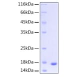 SDS-PAGE - Recombinant Human UBE2D3 Protein (C-terminal His Tag) (A331392) - Antibodies.com