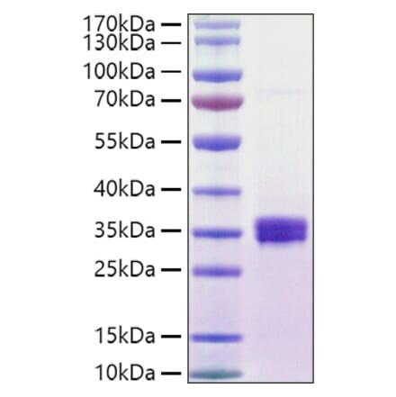 SDS-PAGE - Recombinant Human ULBP1 Protein (C-terminal His and Avi Tag) (A331394) - Antibodies.com