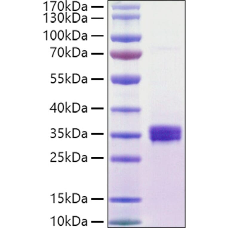 SDS-PAGE - Recombinant Human ULBP1 Protein (C-terminal His and Avi Tag) (A331394) - Antibodies.com