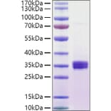 SDS-PAGE - Recombinant Human ULBP1 Protein (C-terminal His and Avi Tag) (A331394) - Antibodies.com