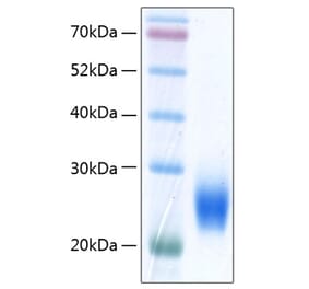 SDS-PAGE - Recombinant Human ULBP2 Protein (C-terminal His Tag) (A331395) - Antibodies.com