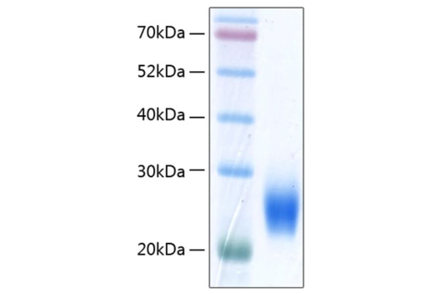 SDS-PAGE - Recombinant Human ULBP2 Protein (C-terminal His Tag) (A331395) - Antibodies.com
