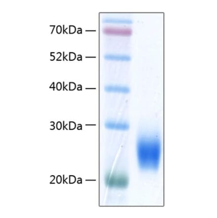 SDS-PAGE - Recombinant Human ULBP2 Protein (C-terminal His Tag) (A331395) - Antibodies.com