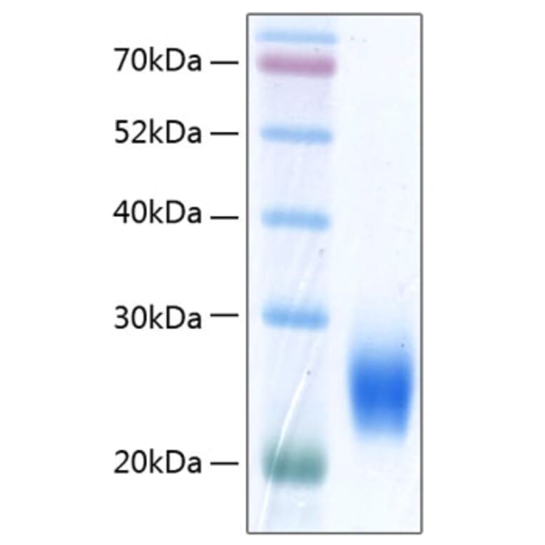 SDS-PAGE - Recombinant Human ULBP2 Protein (C-terminal His Tag) (A331395) - Antibodies.com