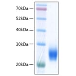 SDS-PAGE - Recombinant Human ULBP2 Protein (C-terminal His Tag) (A331395) - Antibodies.com