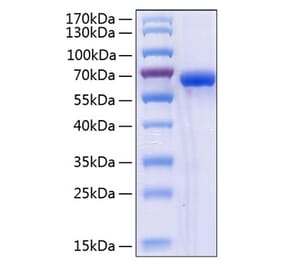 SDS-PAGE - Recombinant Human ULBP2 Protein (C-terminal Human Fc and His Tag) (A331396) - Antibodies.com