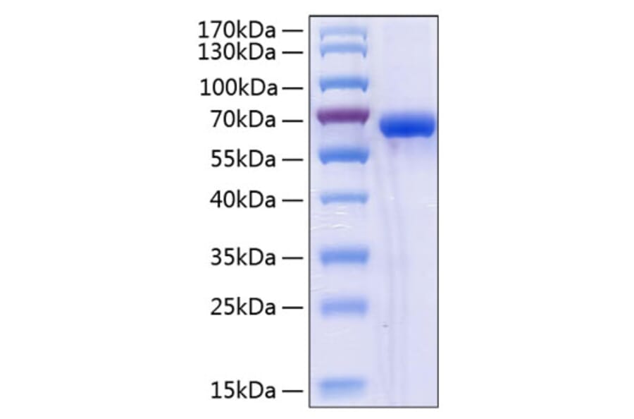SDS-PAGE - Recombinant Human ULBP2 Protein (C-terminal Human Fc and His Tag) (A331396) - Antibodies.com
