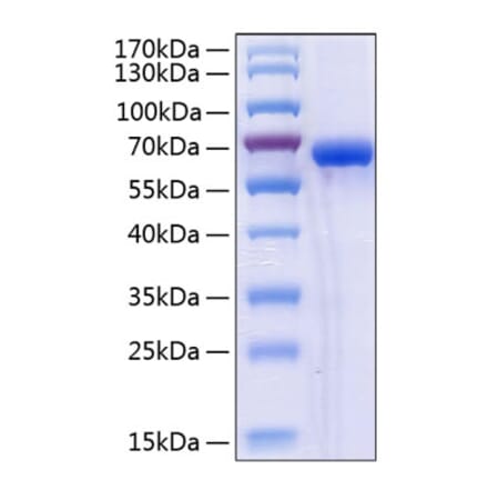 SDS-PAGE - Recombinant Human ULBP2 Protein (C-terminal Human Fc and His Tag) (A331396) - Antibodies.com