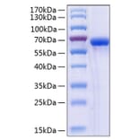 SDS-PAGE - Recombinant Human ULBP2 Protein (C-terminal Human Fc and His Tag) (A331396) - Antibodies.com