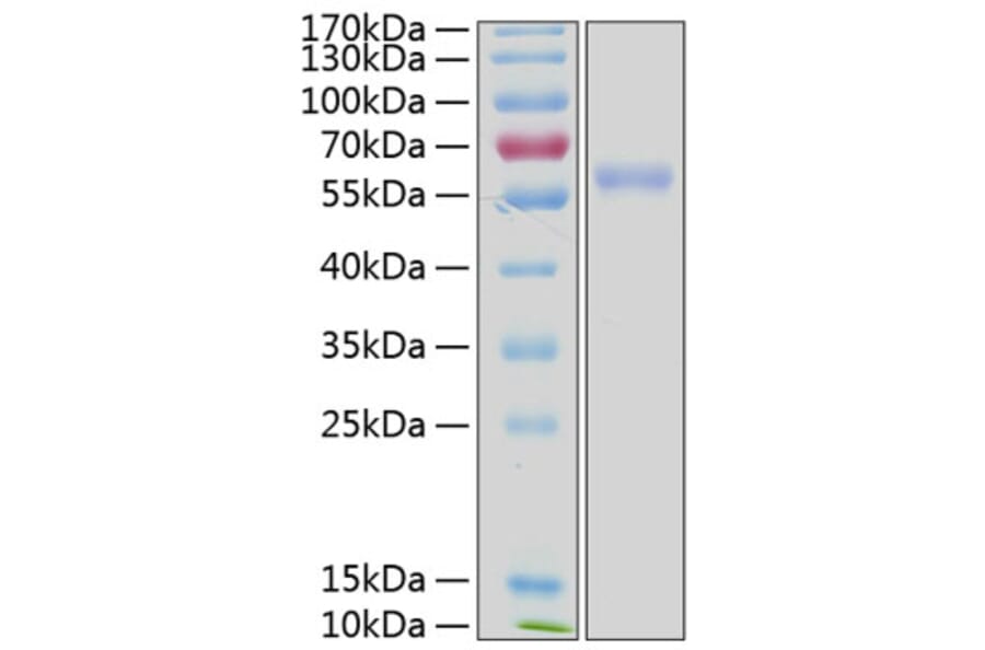 SDS-PAGE - Recombinant Human ULBP3 Protein (C-terminal Human Fc and His Tag) (A331397) - Antibodies.com