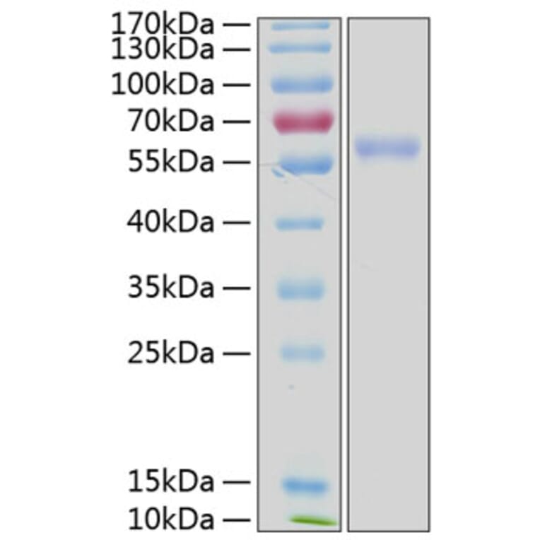 SDS-PAGE - Recombinant Human ULBP3 Protein (C-terminal Human Fc and His Tag) (A331397) - Antibodies.com